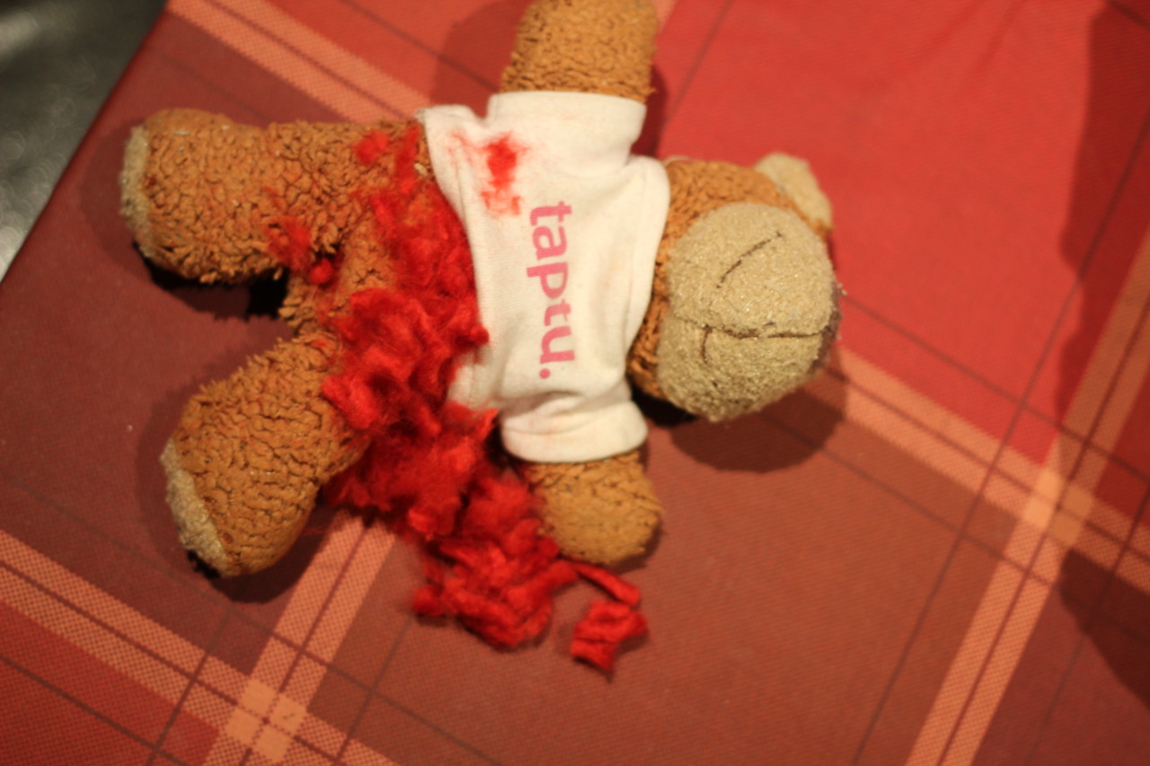 Bearaptu had an accident, but he said it was “just a scratch”.